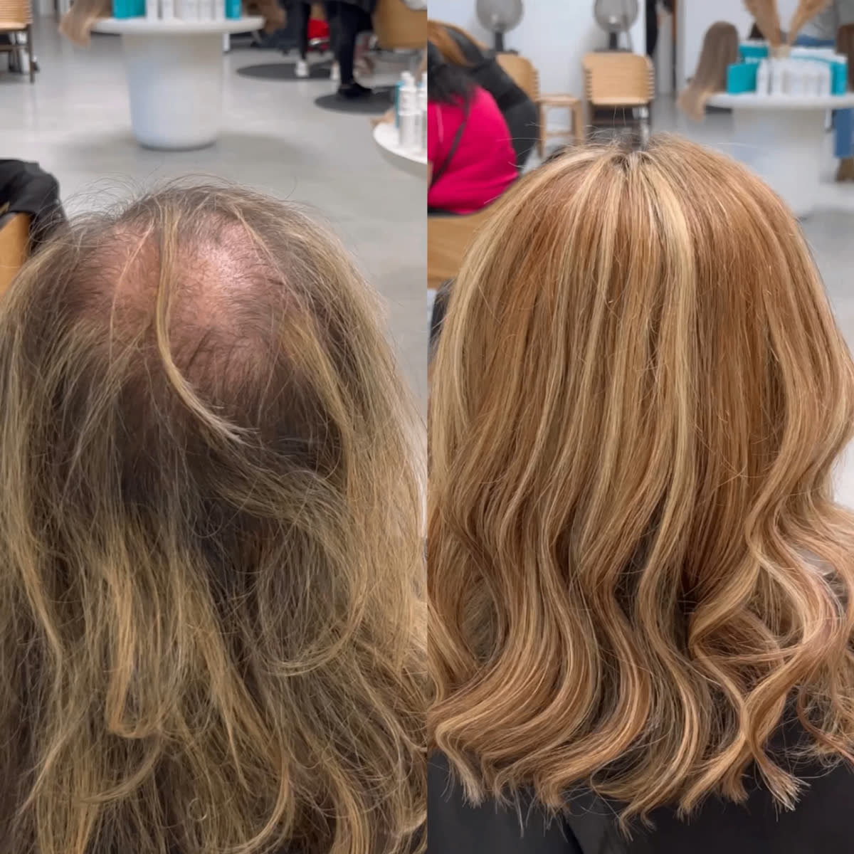 Resultado real de antes e depois 8