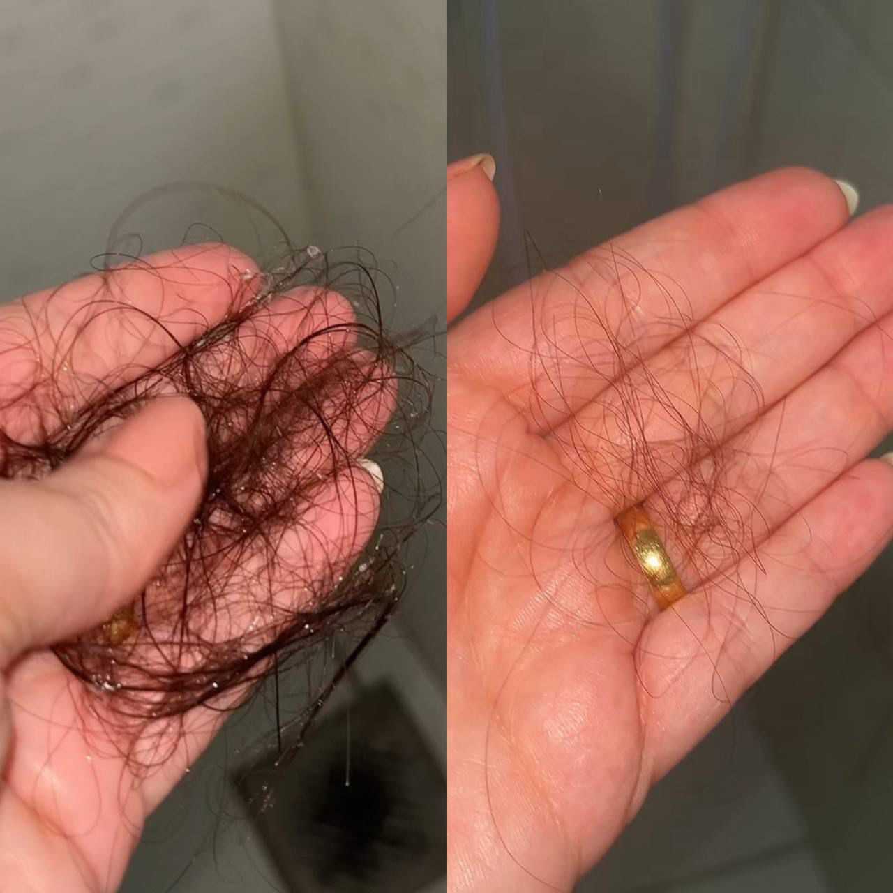 Resultado real de antes e depois 5