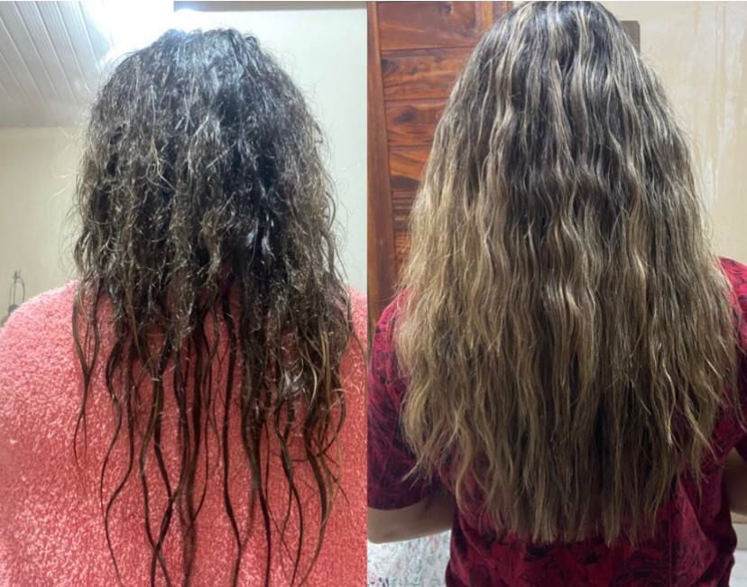 Resultado real de antes e depois 3