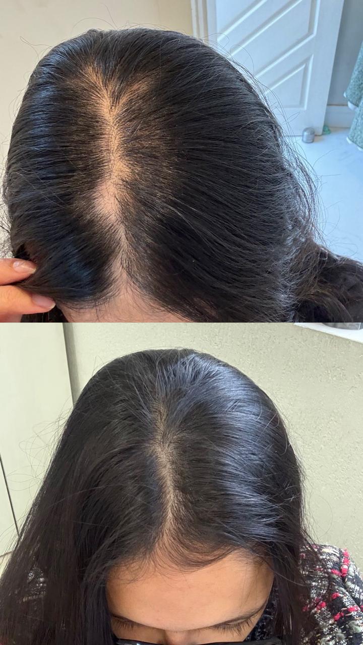 Resultado real de antes e depois 2
